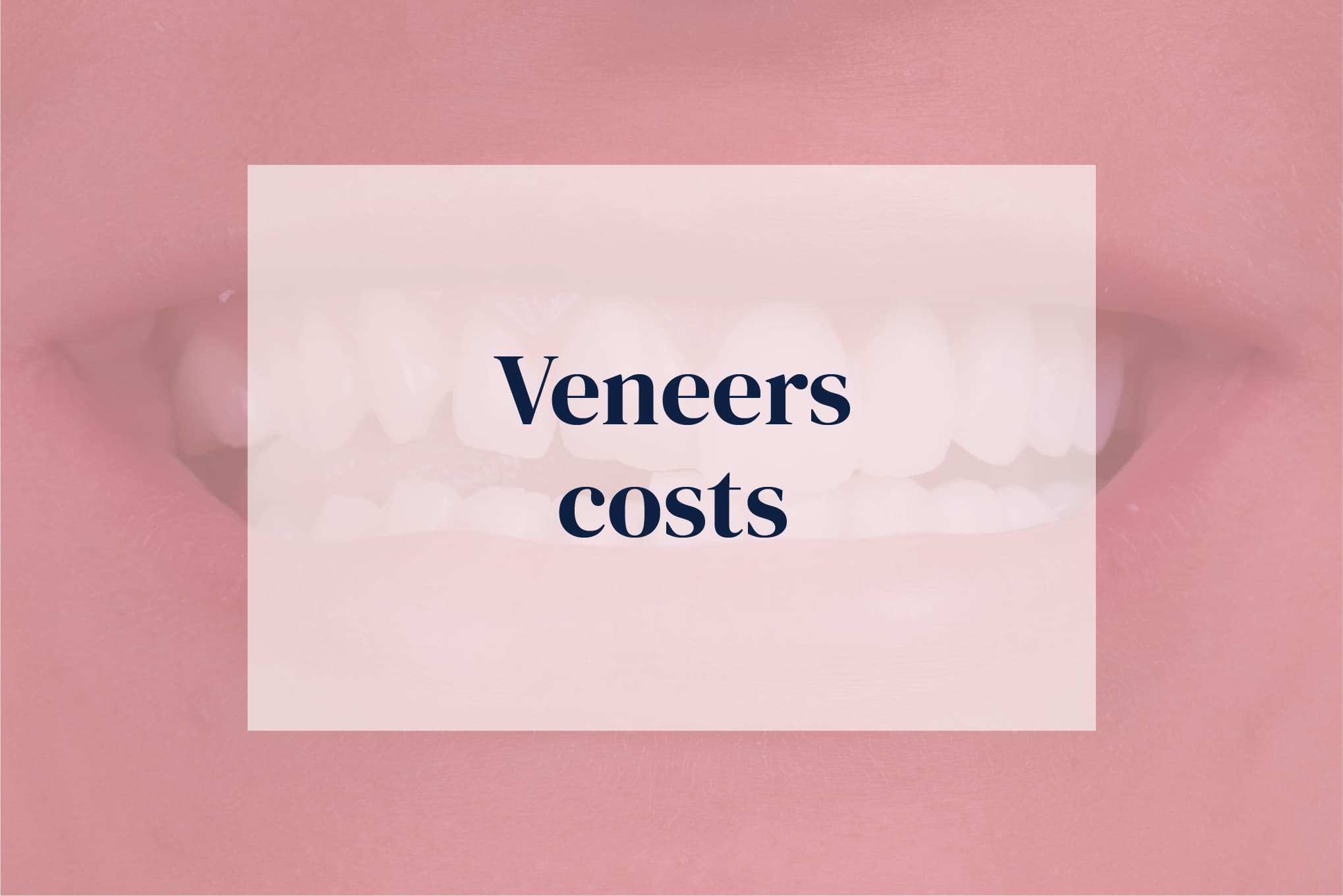Trident Smiles Dental Veneers cost What are the average veneers